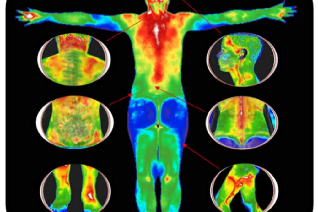 WHAT IS THERMOGRAPHY?