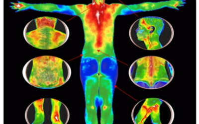 WHAT IS THERMOGRAPHY?