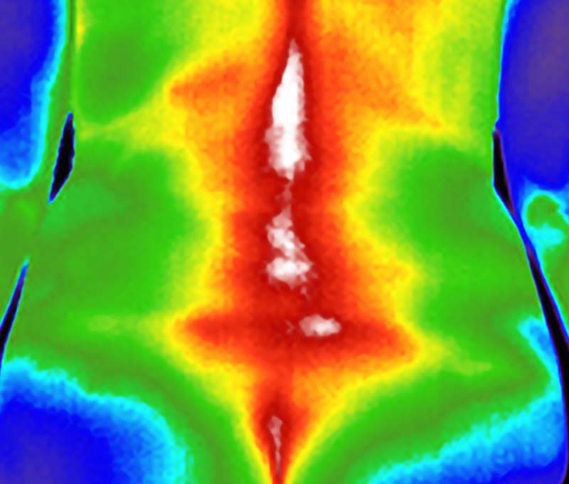 Thermal Medical Imaging Los Angeles